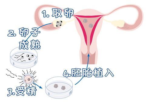 液氮储存